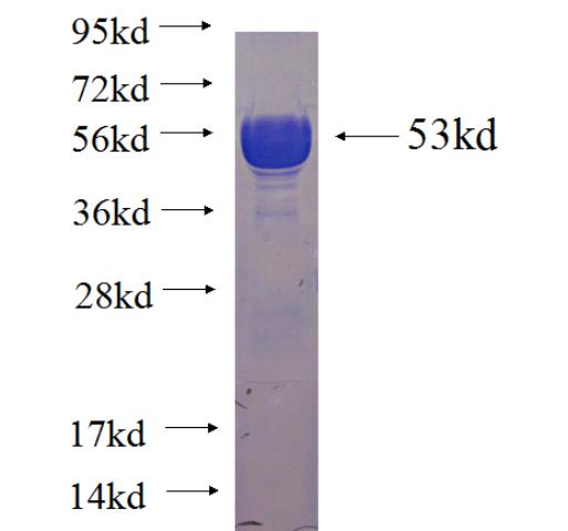 Recombinant human CMTM2 SDS-PAGE