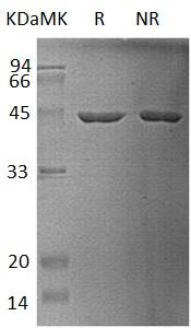 Human HPD/PPD (His tag) recombinant protein