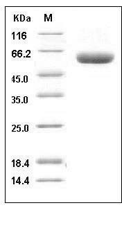 Human DPP7 / DPPII / DPP2 Protein (His Tag) SDS-PAGE