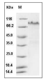 Mouse Notch-1 / NOTCH1 Protein (His Tag) SDS-PAGE