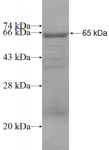 Recombinant Human OSBPL2 SDS-PAGE