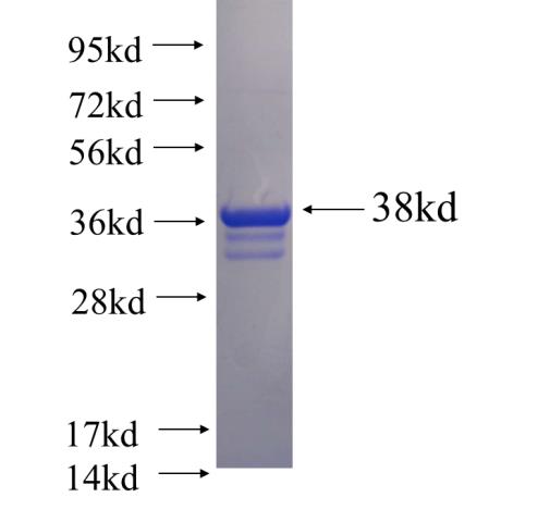 Recombinant human DRD1 SDS-PAGE