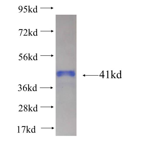 Recombinant human BXDC1 SDS-PAGE