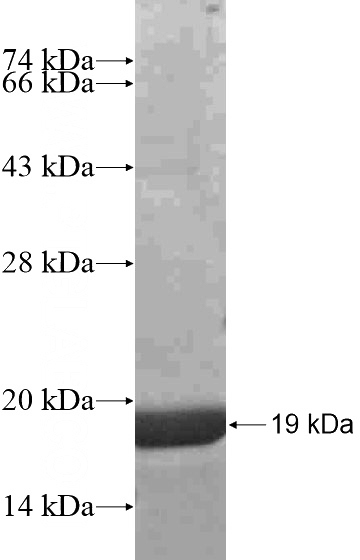 Recombinant Human ZSCAN23 SDS-PAGE