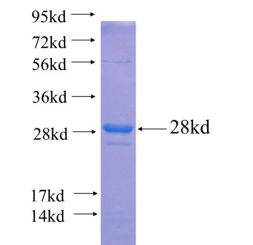 Recombinant human ACMSD SDS-PAGE