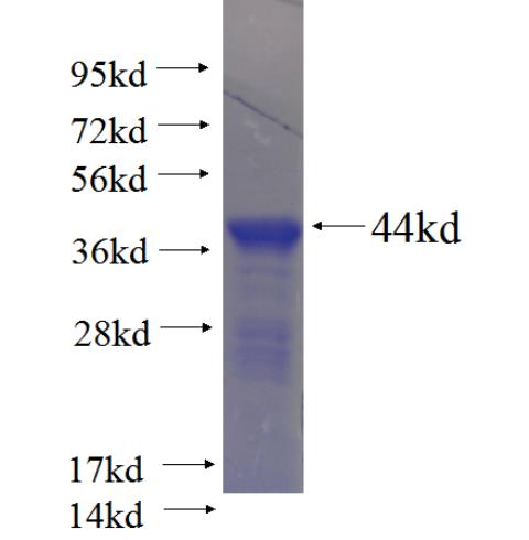 Recombinant Arabidopsis thaliana URT1 SDS-PAGE