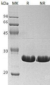 Human BCL2L1/BCL2L/BCLX (His tag) recombinant protein