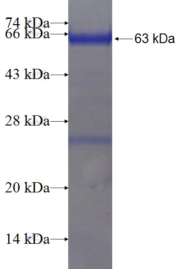 Recombinant Human ARMC5 SDS-PAGE