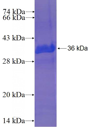 Recombinant Human HSPC152 SDS-PAGE