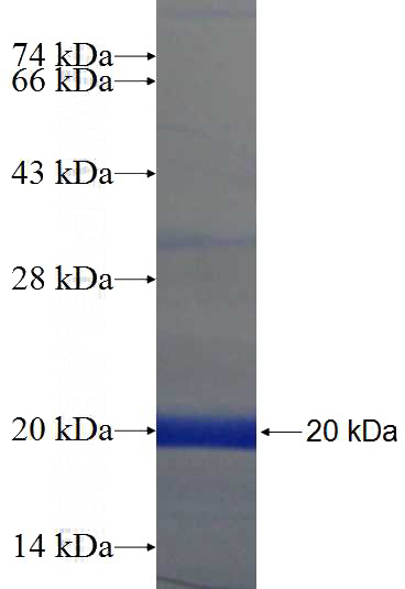 Human IL-1F6 Recombinant protein (6*His tag)