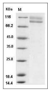 Human IL17RC Protein (Fc Tag) SDS-PAGE