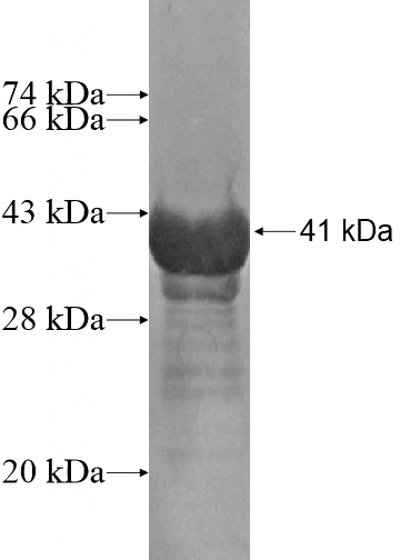 Recombinant Human PITPNM2 SDS-PAGE