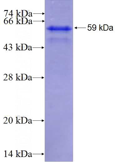 Recombinant Human AZIN1 SDS-PAGE