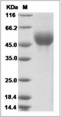 Influenza A H9N2 (A/Duck/HongKong/448/78) Hemagglutinin Protein (His Tag)
