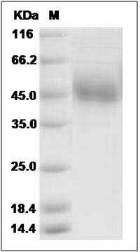 Cynomolgus SIRPG / SIRP gamma / CD172g Protein (His Tag) SDS-PAGE