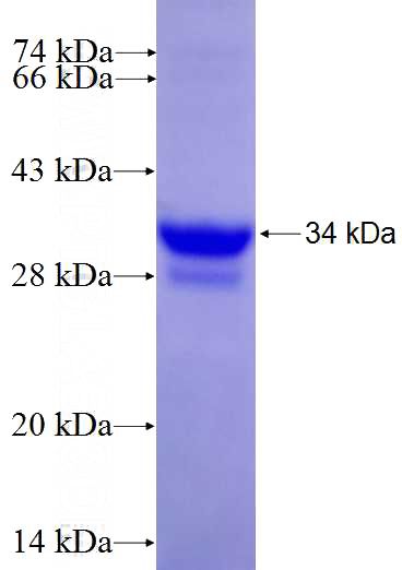 Recombinant Human APOF SDS-PAGE