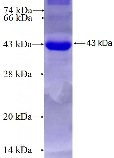 Recombinant Human ARNT,HIF1B SDS-PAGE