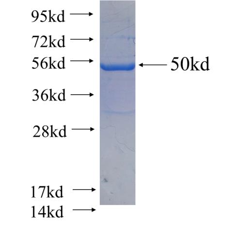 Recombinant human RAB23 SDS-PAGE