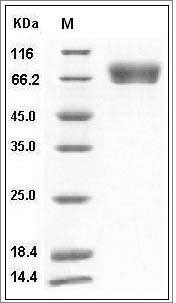 Influenza A H5N1 (A/Indonesia/5/2005) Hemagglutinin / HA Protein (His Tag) SDS-PAGE