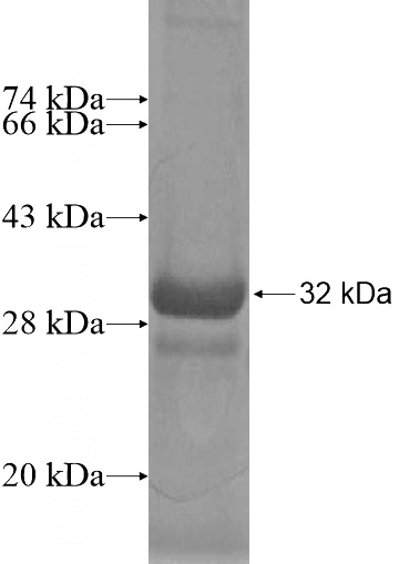 Recombinant Human COQ10A SDS-PAGE