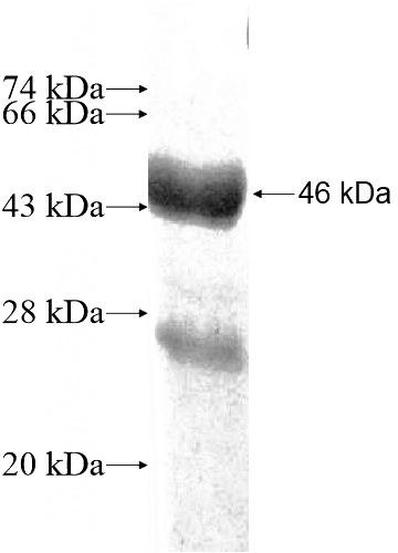 Recombinant Human PPP1R14B SDS-PAGE