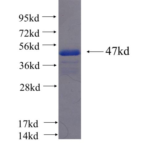 Recombinant human CSRP3 SDS-PAGE