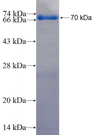 Recombinant Human IQWD1 SDS-PAGE