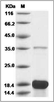 Human DBI / ACBD1 Protein (His Tag) SDS-PAGE