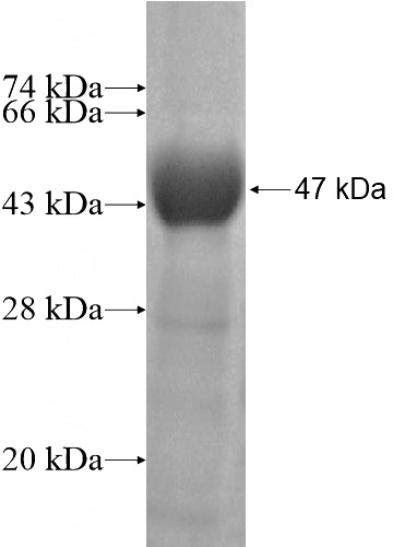 Recombinant Human GRM8 SDS-PAGE
