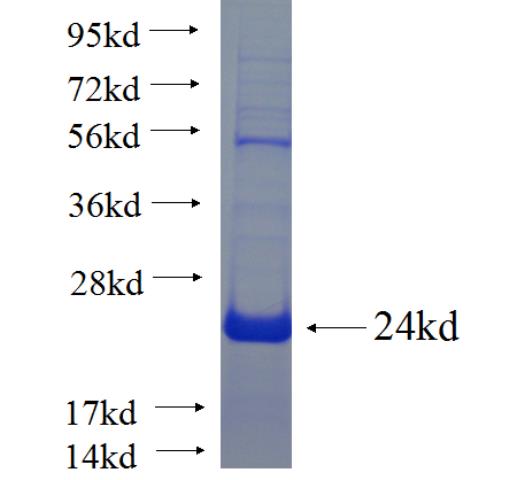 Recombinant human C20orf7 SDS-PAGE