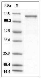 Human USP5 / ISOT Protein (His Tag) SDS-PAGE