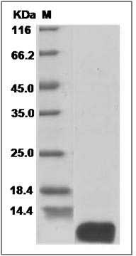 Human ATOX1 / HAH1 Protein (His Tag) SDS-PAGE