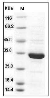 Human ANXA5 / Annexin ? / Annexin A5 Protein SDS-PAGE