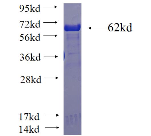 Recombinant human STBD1 SDS-PAGE