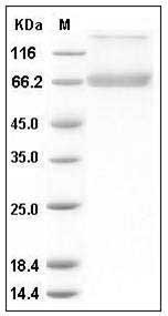 Human Decorin / DCN / SLRR1B Protein (Fc Tag) SDS-PAGE