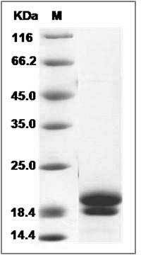 Cynomolgus REG1B / PSPS2 Protein (His Tag) SDS-PAGE