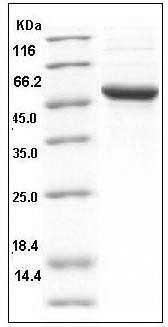 Human Interferon omega-1 / IFN? / IFNW1 Protein (Fc Tag) SDS-PAGE