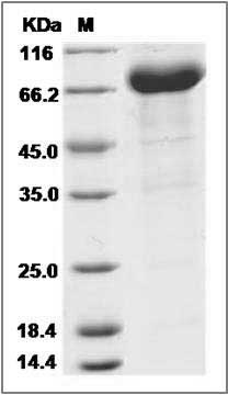 Human FAM171B / KIAA1946 Protein (Fc Tag) SDS-PAGE