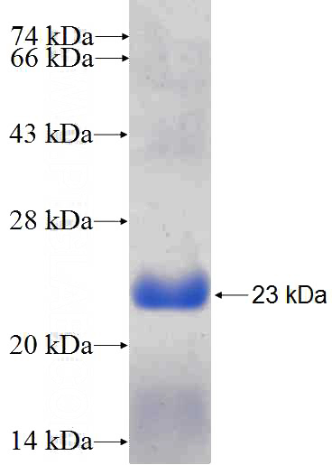 Recombinant Human ARPC5 SDS-PAGE