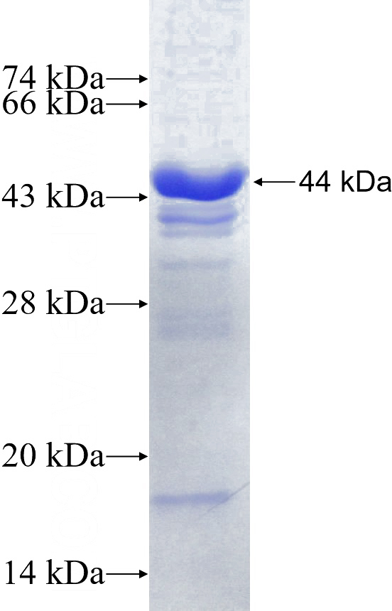 Recombinant Human ACE2 SDS-PAGE
