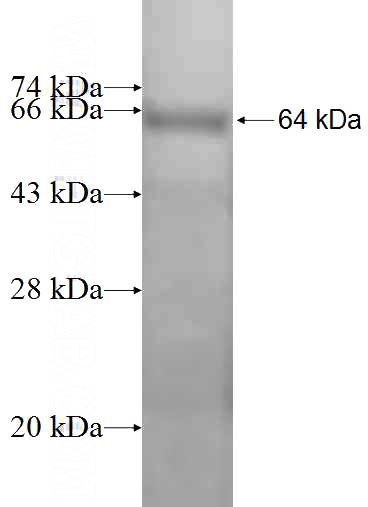 Recombinant Human TKT SDS-PAGE