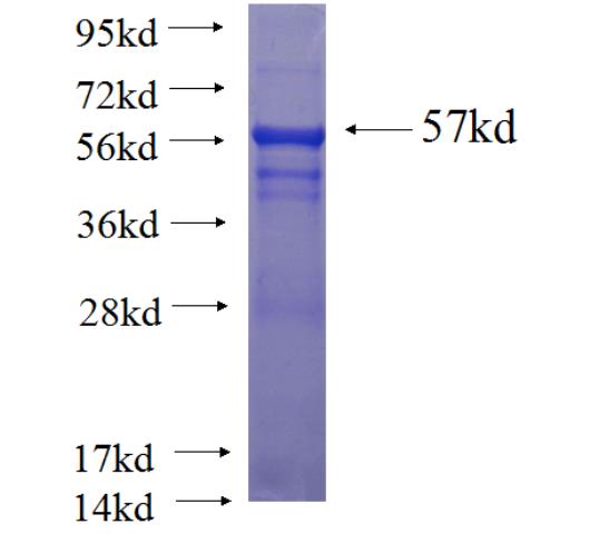 Human TEX264 Recombinant protein (GST tag)