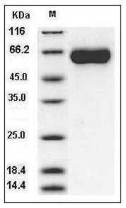 Human MGAT5 / GGNT5 Protein (His Tag) SDS-PAGE