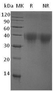 Human PDCD1/PD1 (His tag) recombinant protein