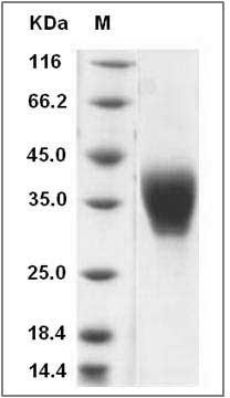 Rat Ephrin-B2 / EFNB2 Protein (His Tag) SDS-PAGE