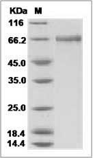 Influenza A H8N4 (A/pintail duck/Alberta/114/1979) Hemagglutinin / HA Protein (His Tag)