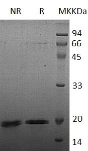 Human ZNRF1/NIN283 (His tag) recombinant protein
