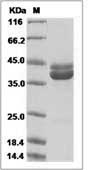 Human Mammaglobin-B / SCGB2A1 Protein (Fc Tag)