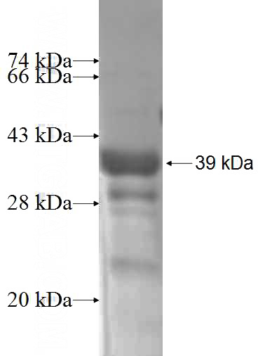 Recombinant Human HEN1,NHLH1 SDS-PAGE