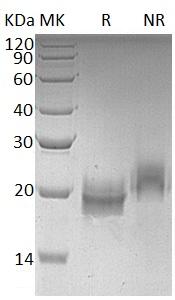 Human TFF2/SML1 (His tag) recombinant protein